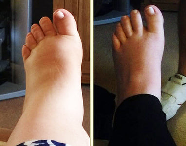 Navoa Ankle Relief Pro